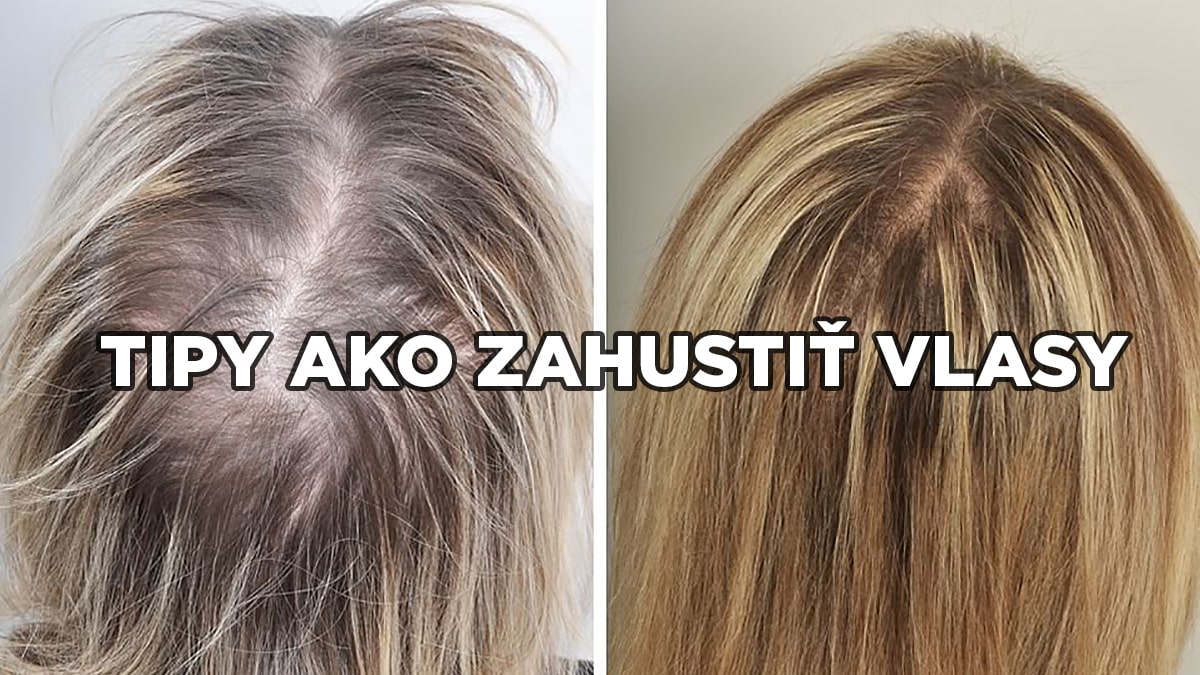 Zahustenie vlasov - rady ako najlepšie dosiahnuť plný účes