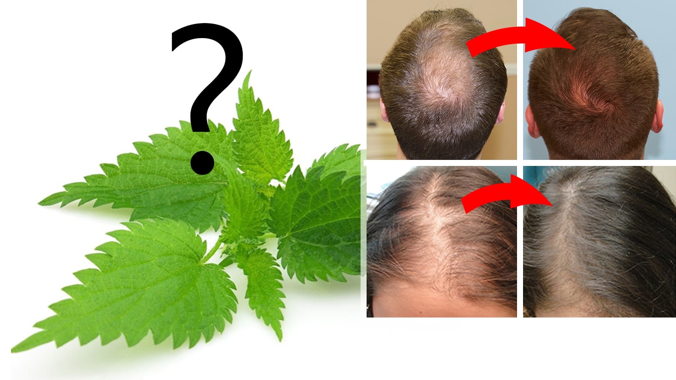 Aké má žihľava účinky na vlasy alebo proti vypadávaniu vlasov?