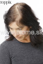 Zahusťovač vlasov Toppik - fotky pred a po