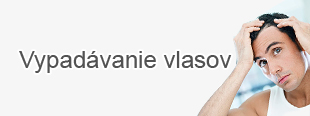 Vypadávanie vlasov u mužov