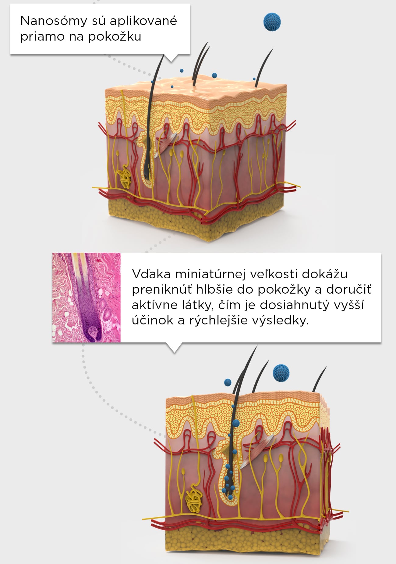 Tchnológia nanosomov pre lepšie dodanie výživných látok do pokožky - vďaka miniatúrnej veľkosti dokážu preniknúť hlbšie do pokožky a doručiť aktívne látky čím je dosiahnutý vyšší účinok a rýchlejšie výsledky.