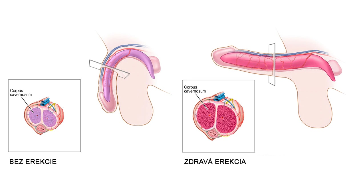 Obr. vľavo - penis bez erekcie, špongiovité telieska nie sú naplnené krvou. Obr.